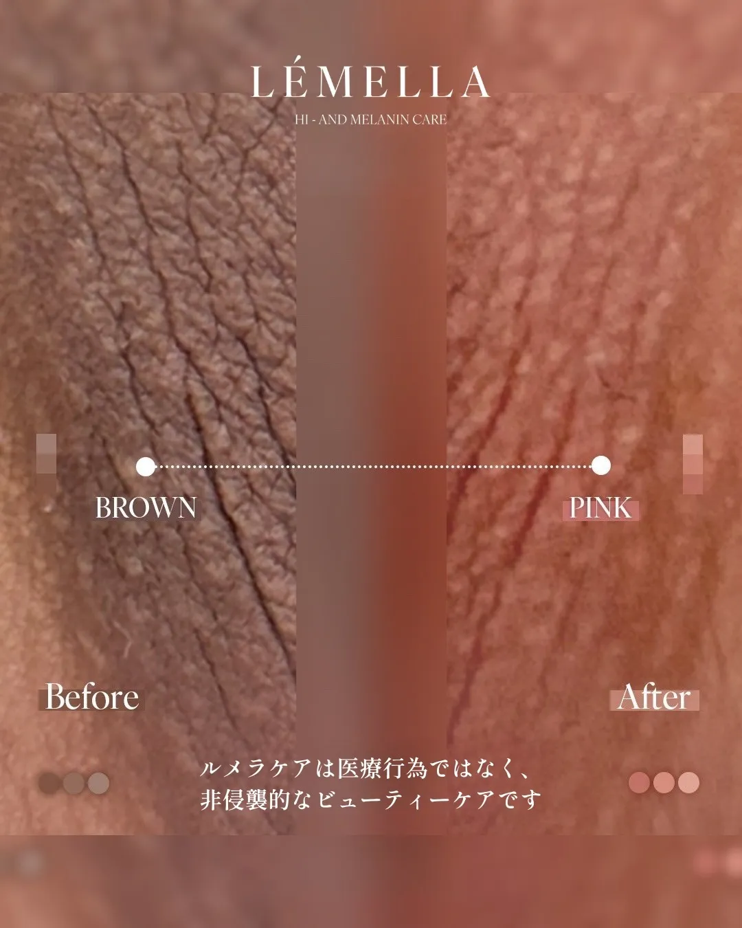 事例③