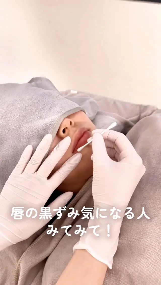 「昔より唇が黒っぽくなった気がする」